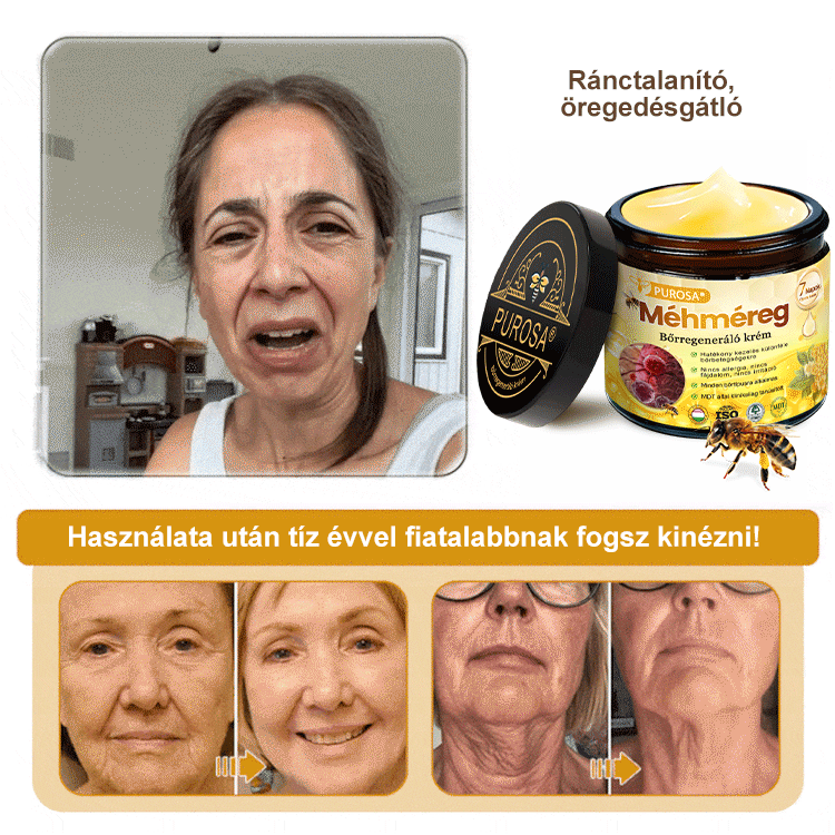 🐝PUROSA® Méhméreg Bőrmegújító Krém|Teljes körű megoldás a makacs bőrproblémák, például az öregedés, ekcéma, hegek és pikkelysömör ellen