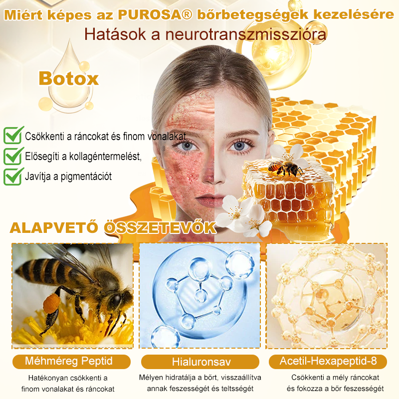🐝PUROSA® Méhméreg Bőrmegújító Krém|Teljes körű megoldás a makacs bőrproblémák, például az öregedés, ekcéma, hegek és pikkelysömör ellen