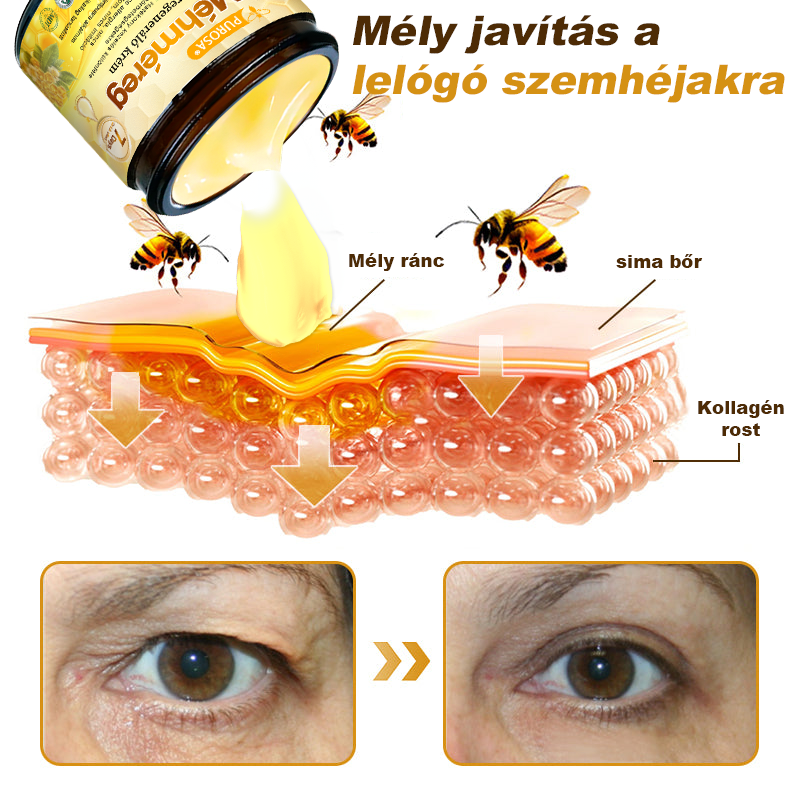 🐝PUROSA® Méhméreg Bőrmegújító Krém|Teljes körű megoldás a makacs bőrproblémák, például az öregedés, ekcéma, hegek és pikkelysömör ellen