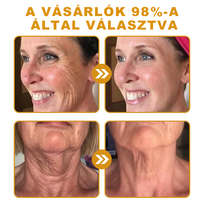 🐝PUROSA® Méhméreg Bőrmegújító Krém|Teljes körű megoldás a makacs bőrproblémák, például az öregedés, ekcéma, hegek és pikkelysömör ellen
