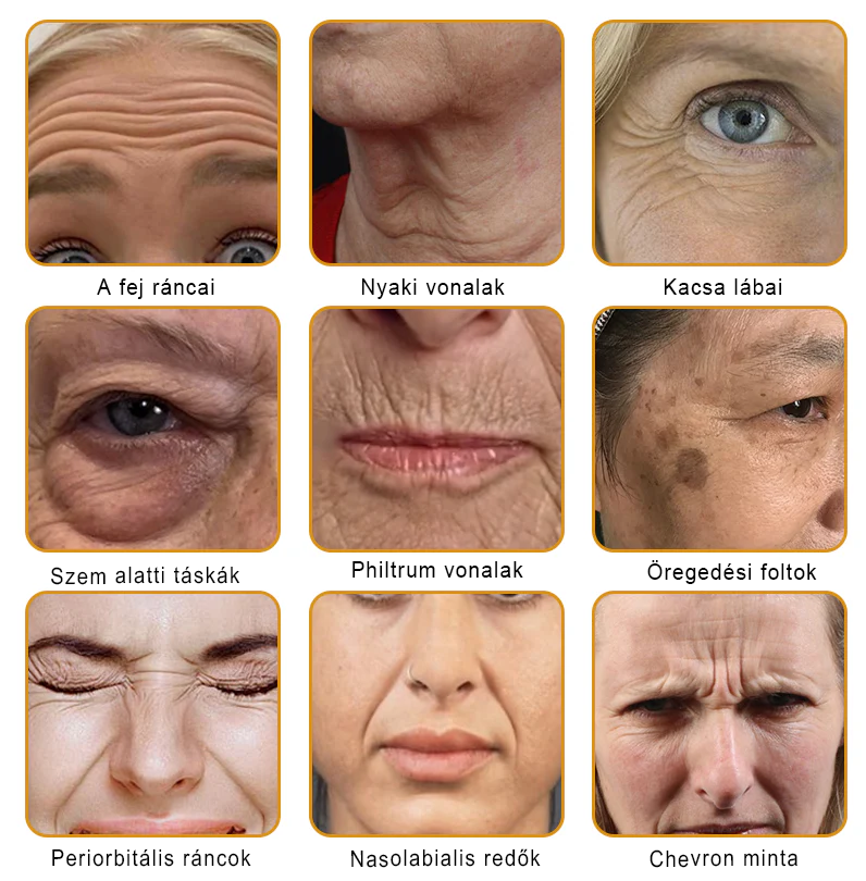 🐝PUROSA® Méhméreg Bőrmegújító Krém|Teljes körű megoldás a makacs bőrproblémák, például az öregedés, ekcéma, hegek és pikkelysömör ellen