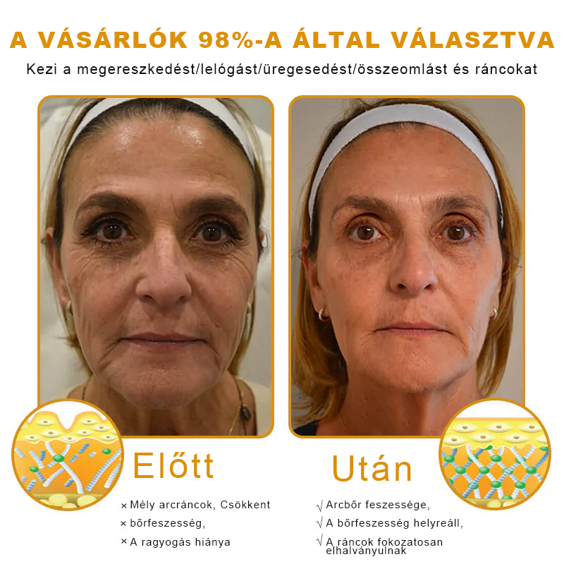 🐝PUROSA® Méhméreg Bőrmegújító Krém|Teljes körű megoldás a makacs bőrproblémák, például az öregedés, ekcéma, hegek és pikkelysömör ellen